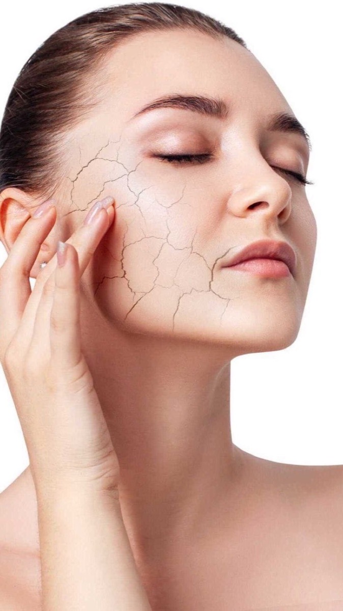 Da khô và da mất nước: phân biệt, nguyên nhân và cách chăm sóc