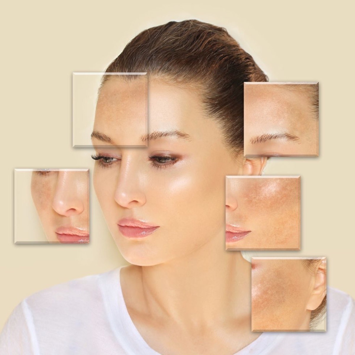 Quản lý sắc tố da: nám, tàn nhang và thâm mụn